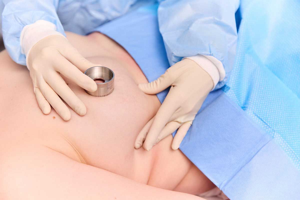 Summary of Breast Implant Patient Decision Checklist