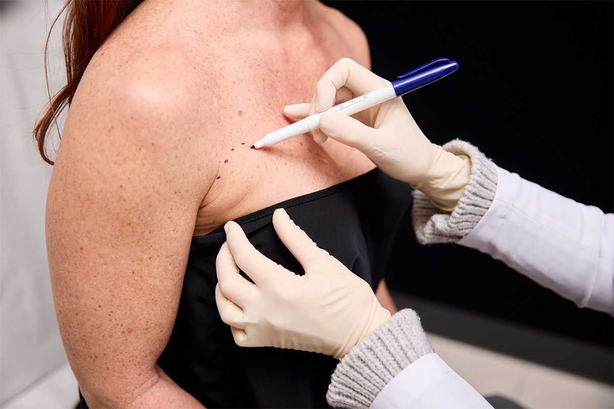The Bigger the Implant, The Bigger the Risk 